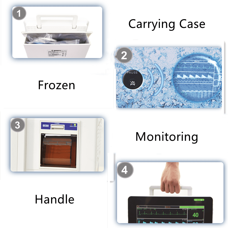 Patient Monitor features 1