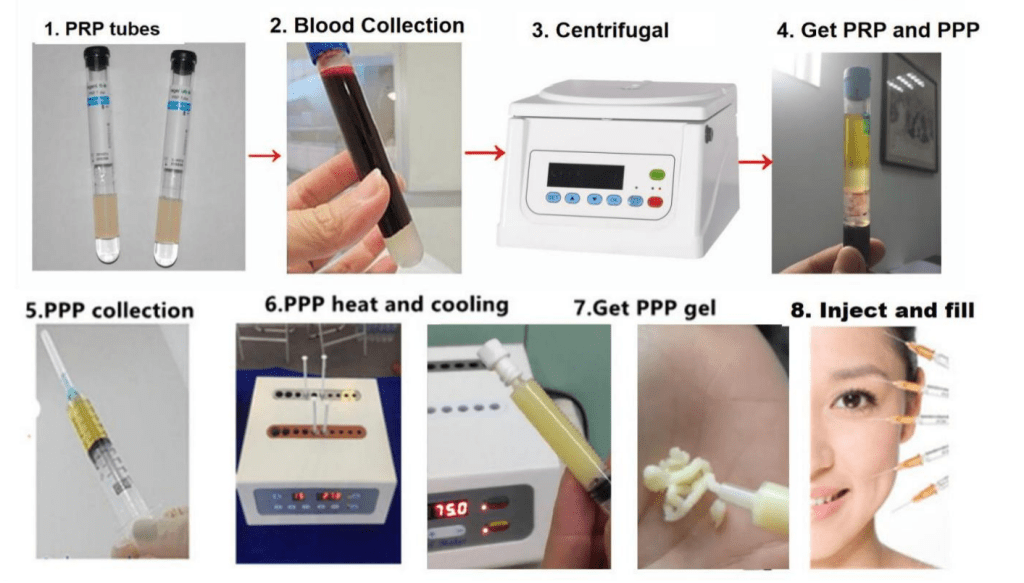 PPP gel make process