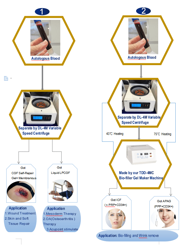 Compare of 3 generation of blood active substance PRP PRF CGF