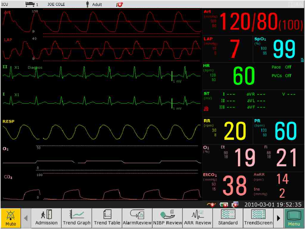 How To Correctly Read The Information Displayed On The Patient Monitor