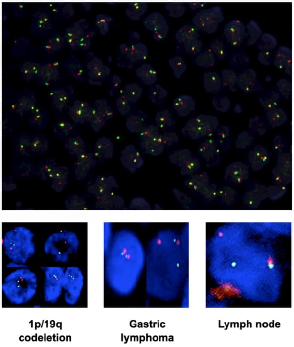 Fluorescence in situ hybridization