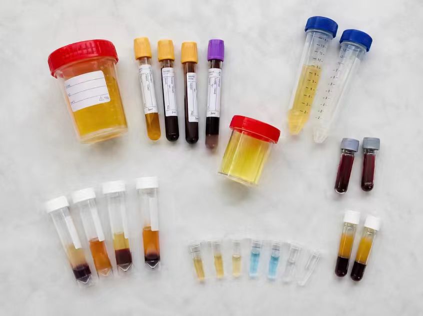 Serum Plasma