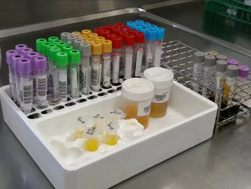 Urine Samples