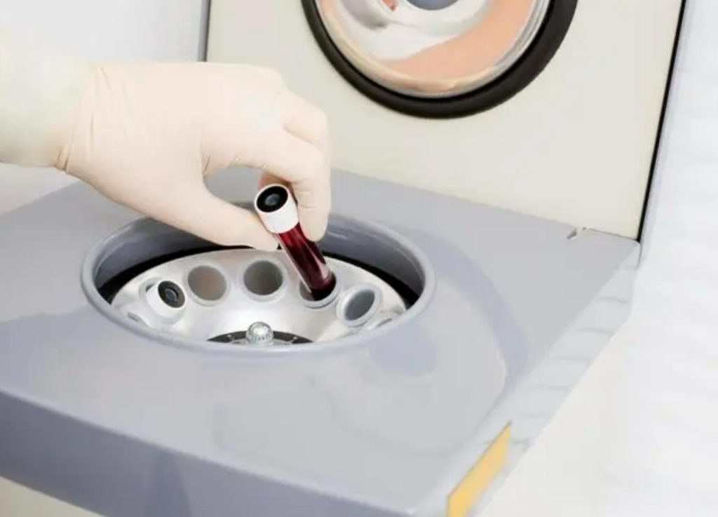 Centrifuges in Blood Banks