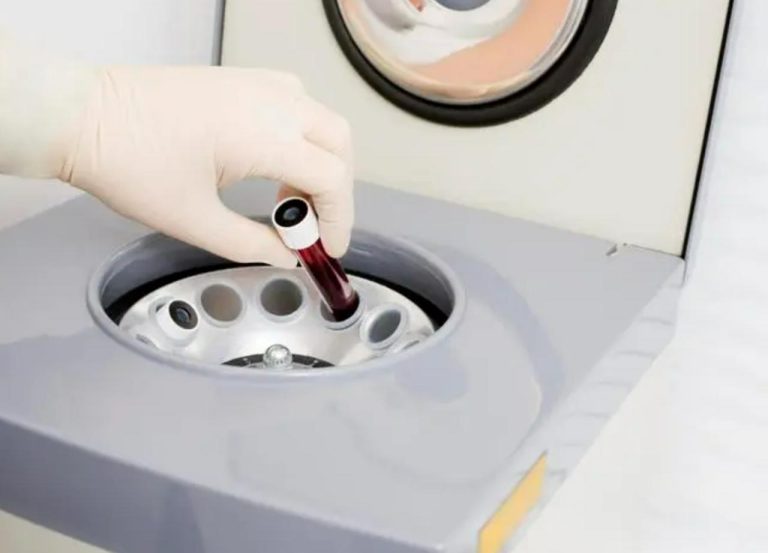 The Pivotal Role of Centrifuges in Blood Bank: The Lifeblood of Separation