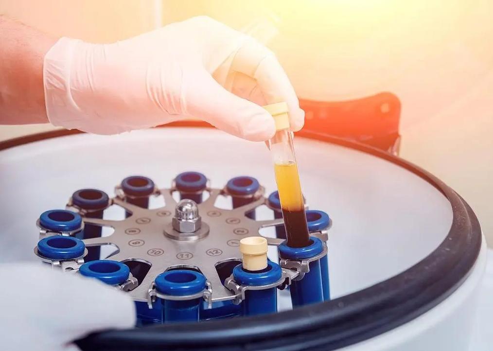 Blood in Centrifuge