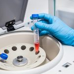Laboratory Sample Separation Equipment - centrifuge