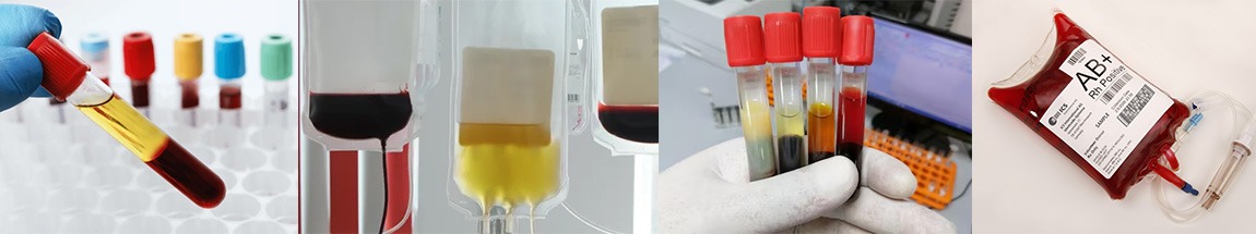application for blood bank centrifuge