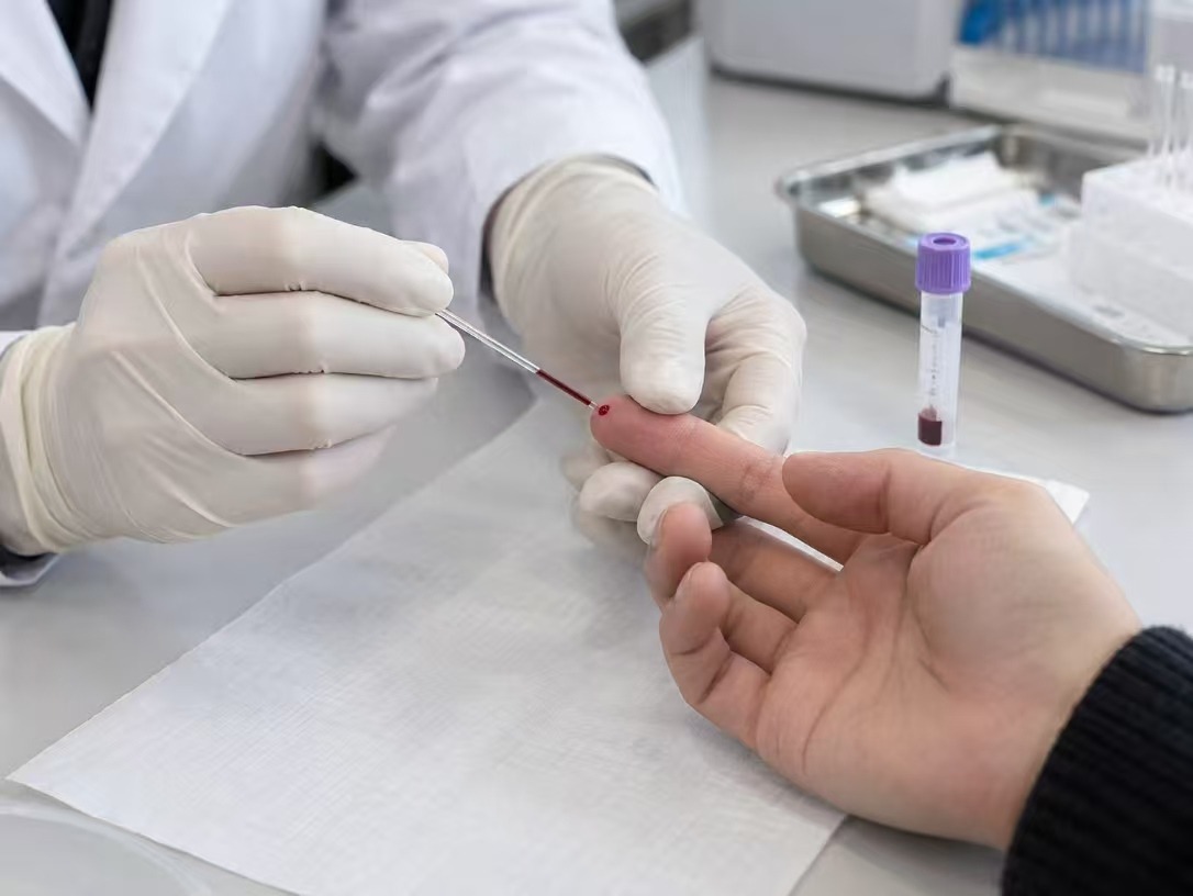 Peripheral Blood Sample