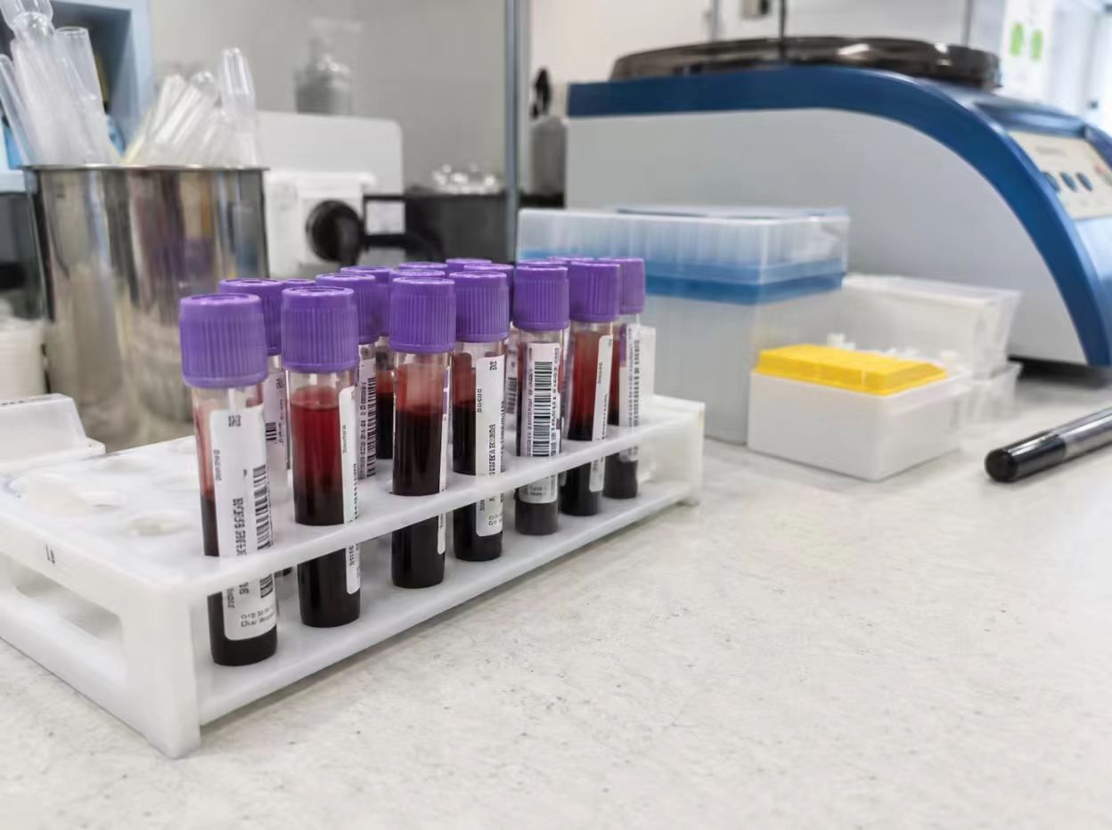 Venous Whole Blood
